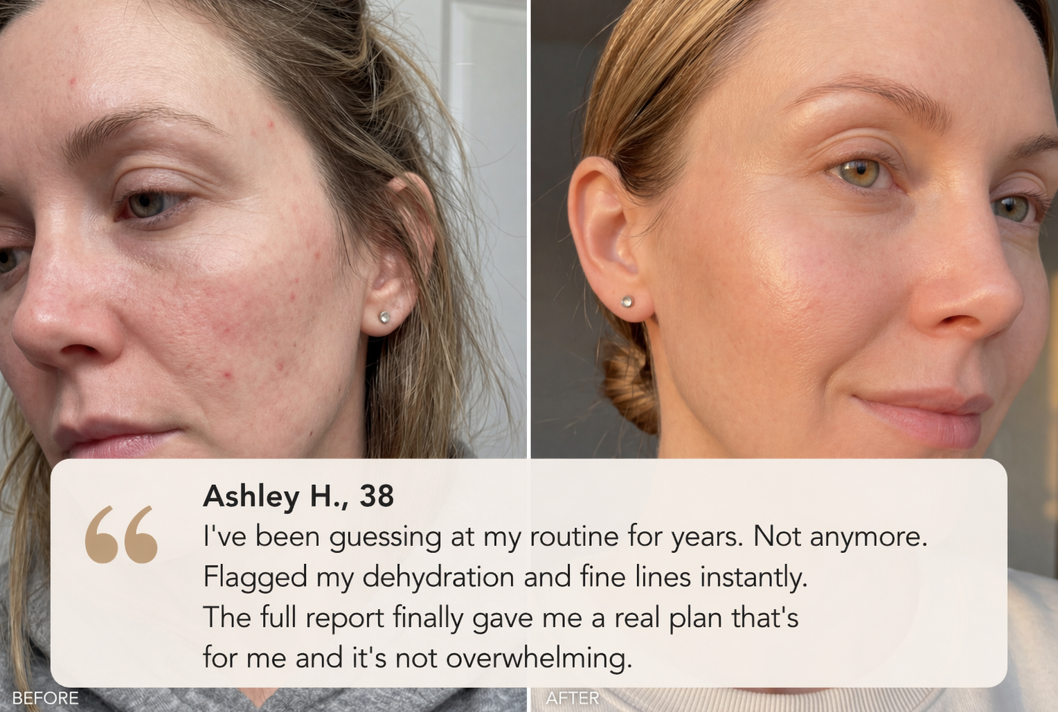Skin transformation results