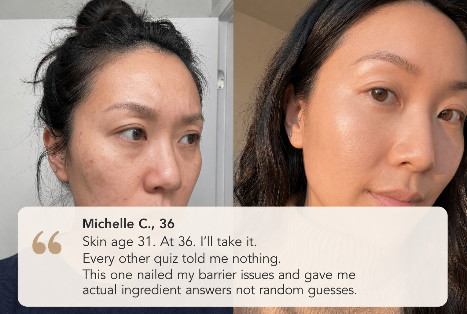 Skin transformation results