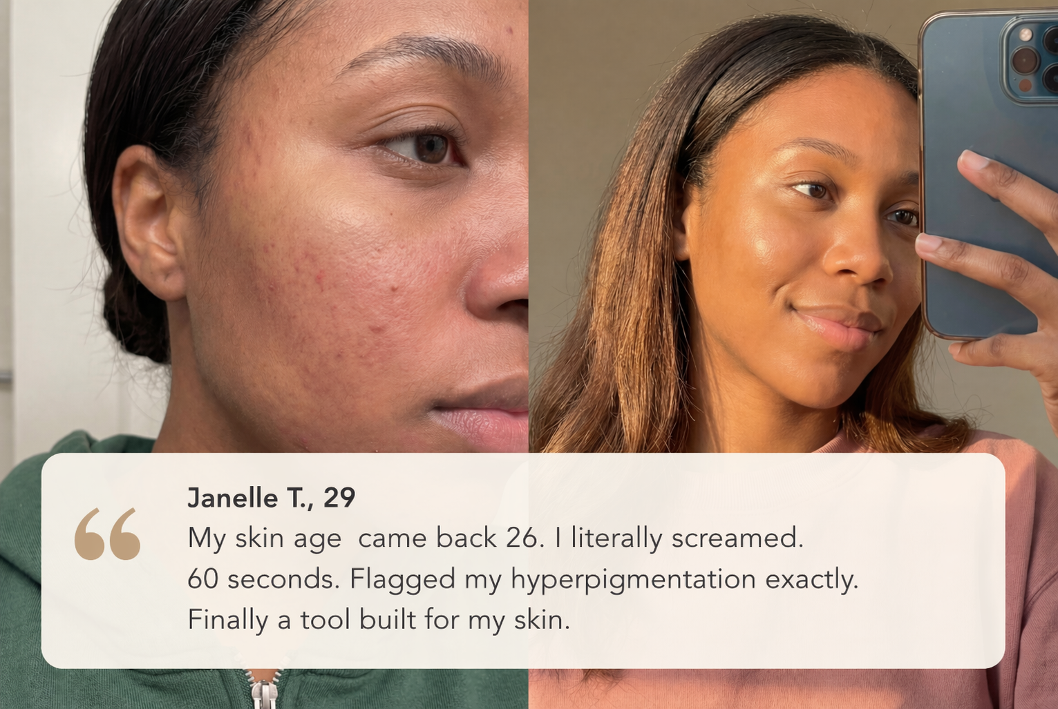 Skin transformation results