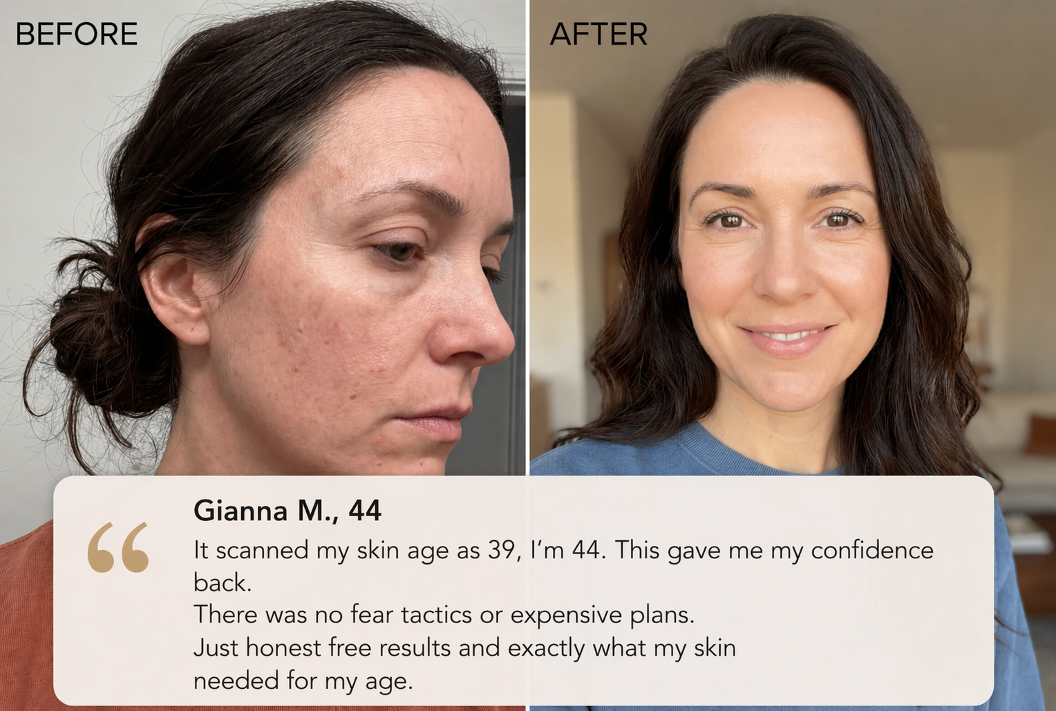Skin transformation results