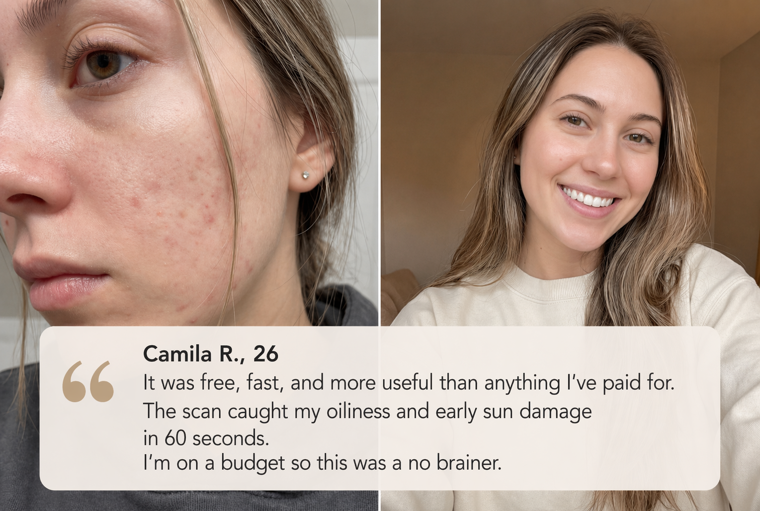 Skin transformation results