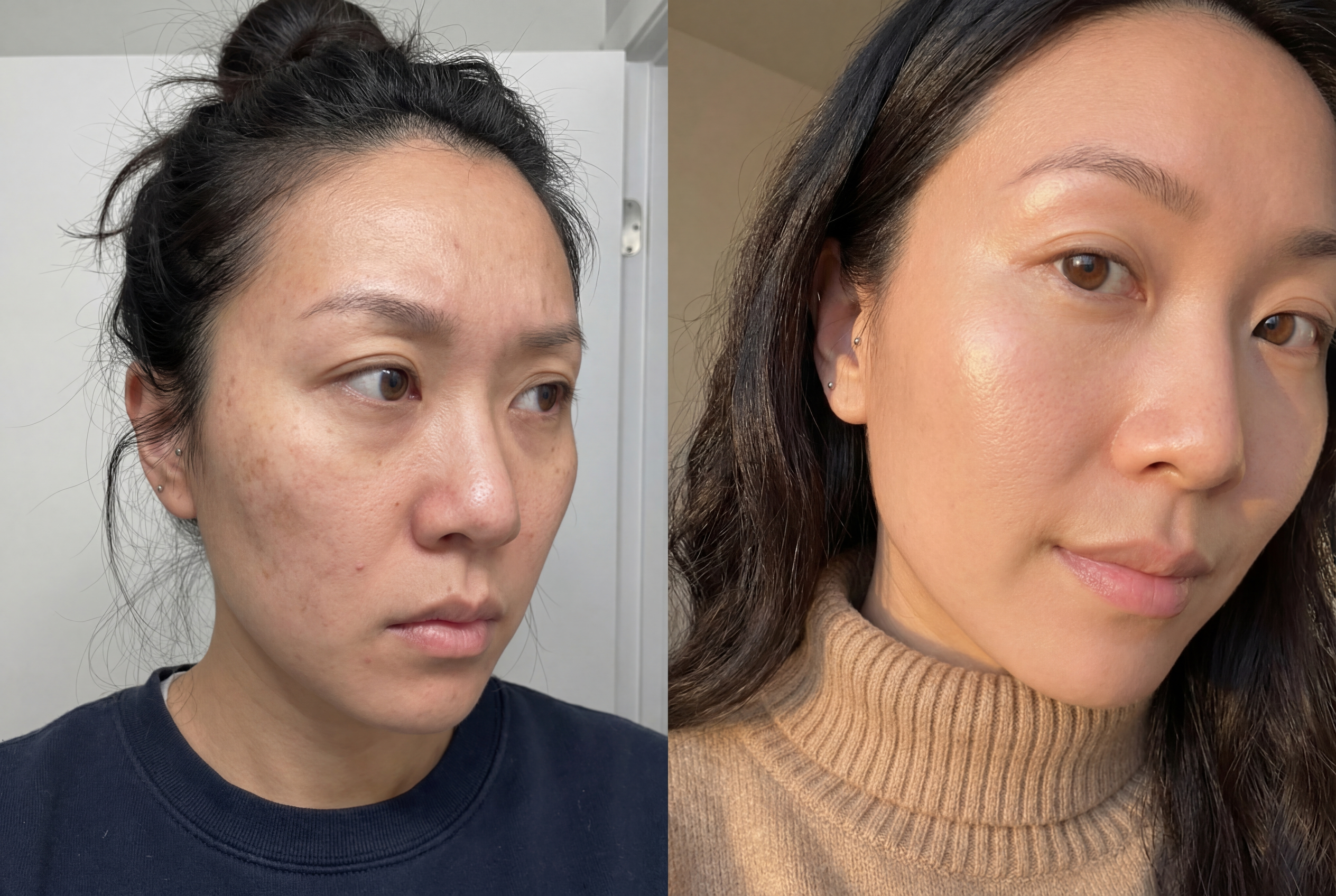 Skin transformation results