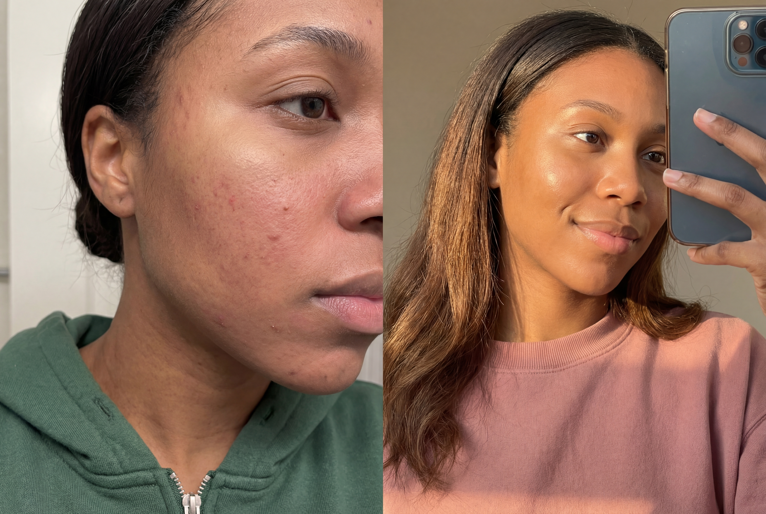Skin transformation results