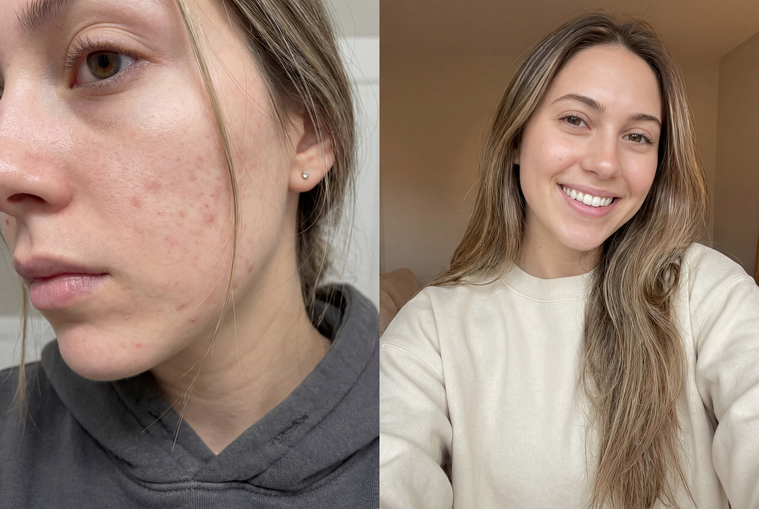 Skin transformation results